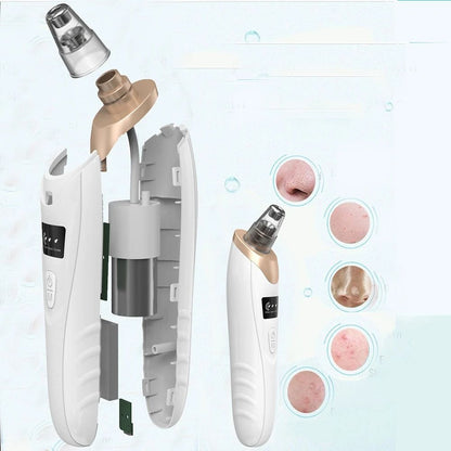 5-in-1 Acne & Blackhead Remover