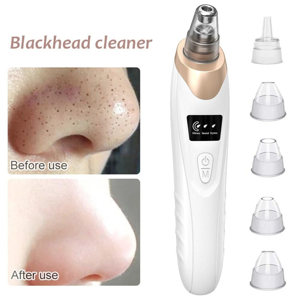 5-in-1 Acne & Blackhead Remover